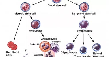 Chronic Lymphocytic Leukemia 