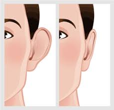 Ear Shape Correction Surgery