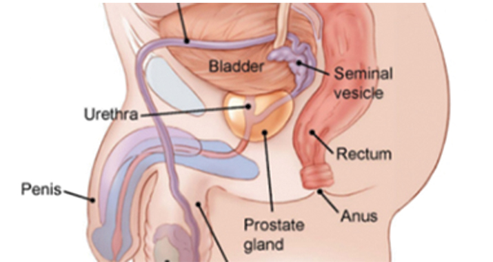 An Overview: Prostate Cancer