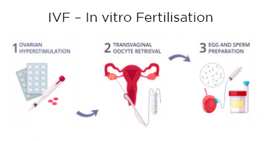 What is Fertility Tourism?