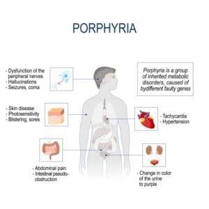 Symptoms of Porphyria