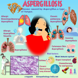 symptoms of aspergillosis
