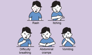 symptoms of drug allergy