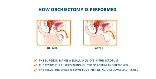 What is the recovery time for orchiectomy?
