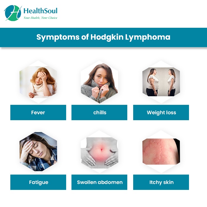 Symptoms of Hodgkin’s lymphoma 
