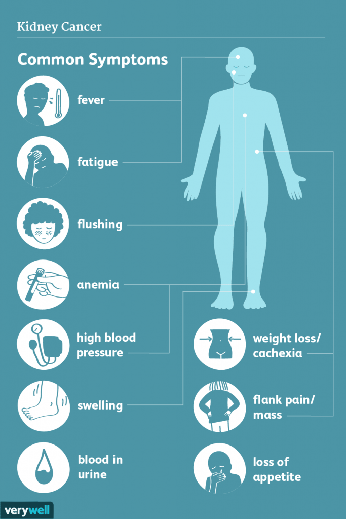 symptoms of kidney cancer