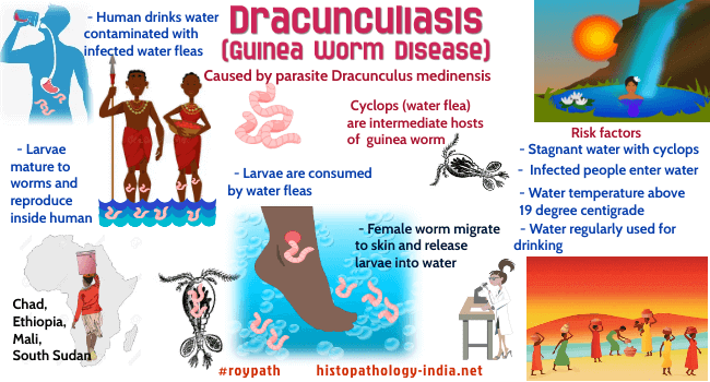 CAUSES OF DRACUNCULIASIS