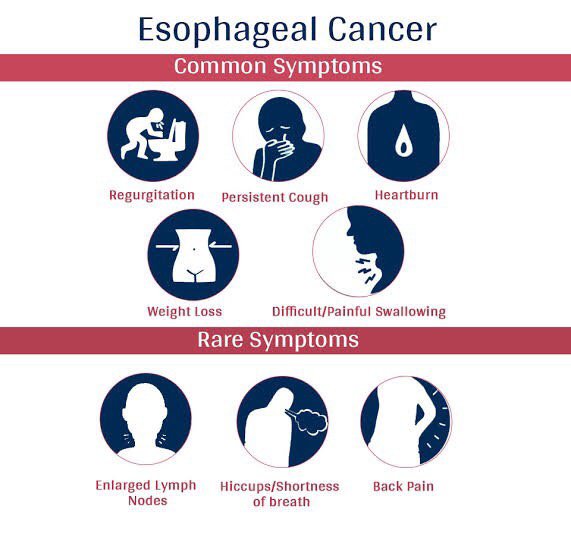 Symptoms of oesophageal cancer