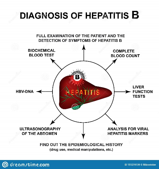 Diagnosis of Hepatitis B