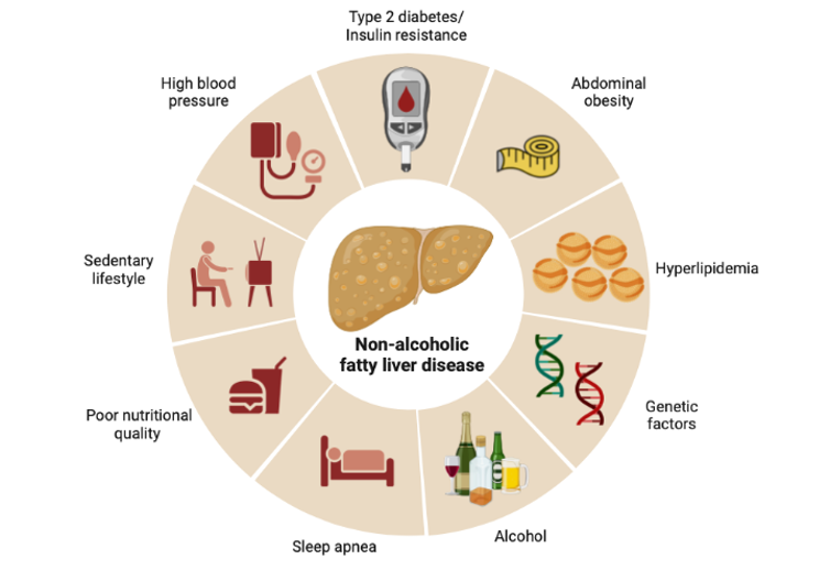 causes and risk factors of NAFLD