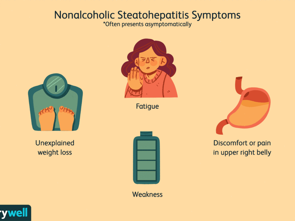 symptoms of non-alcoholic steatohepatitis
